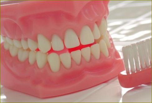Dantų protezų higiena